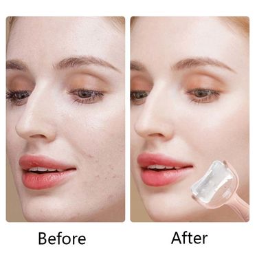 Silicone Cryotherapy Ice Roller